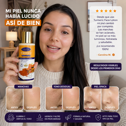 Loción Facial de Cúrcuma para Manchas